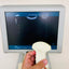 MEDISON X6 COLOR  DOPPLER WITH TVS AND CONVEX PROBES. BH