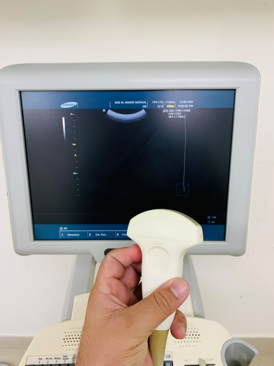 MEDISON X6 COLOR  DOPPLER WITH TVS AND CONVEX PROBES. BH