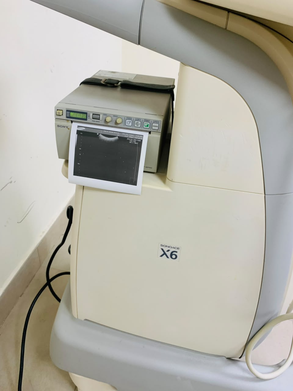 MEDISON X6 COLOR  DOPPLER WITH TVS AND CONVEX PROBES. BH