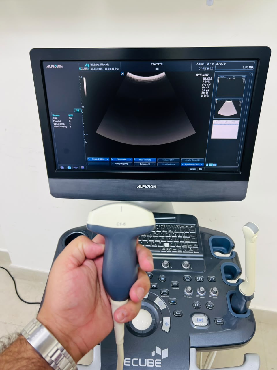 Alpinion E-cube 7 ultrasound machine with TVS and Convex probes. BH