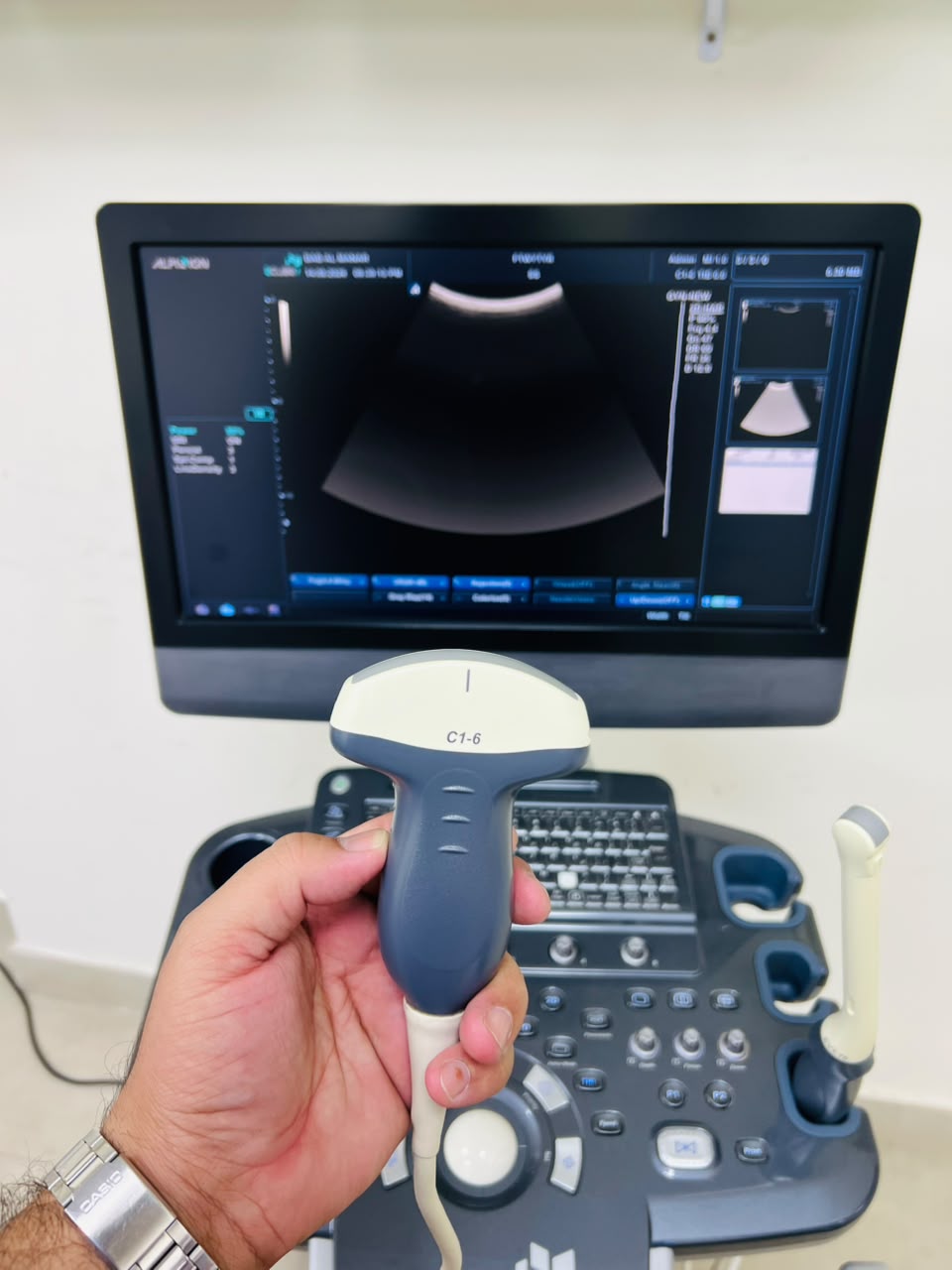 Alpinion E-cube 7 ultrasound machine with TVS and Convex probes. BH