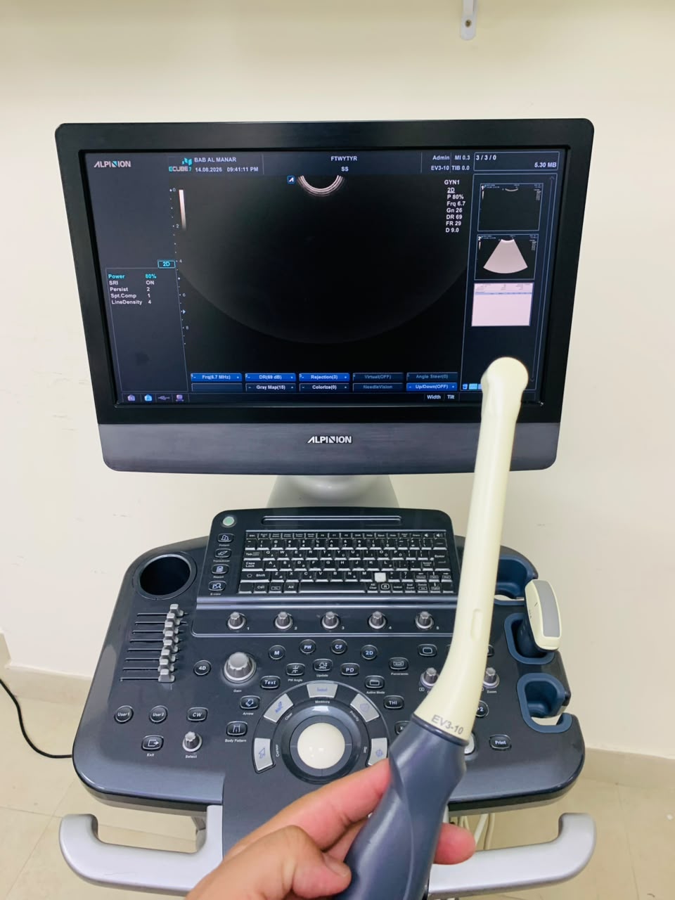 Alpinion E-cube 7 ultrasound machine with TVS and Convex probes. BH