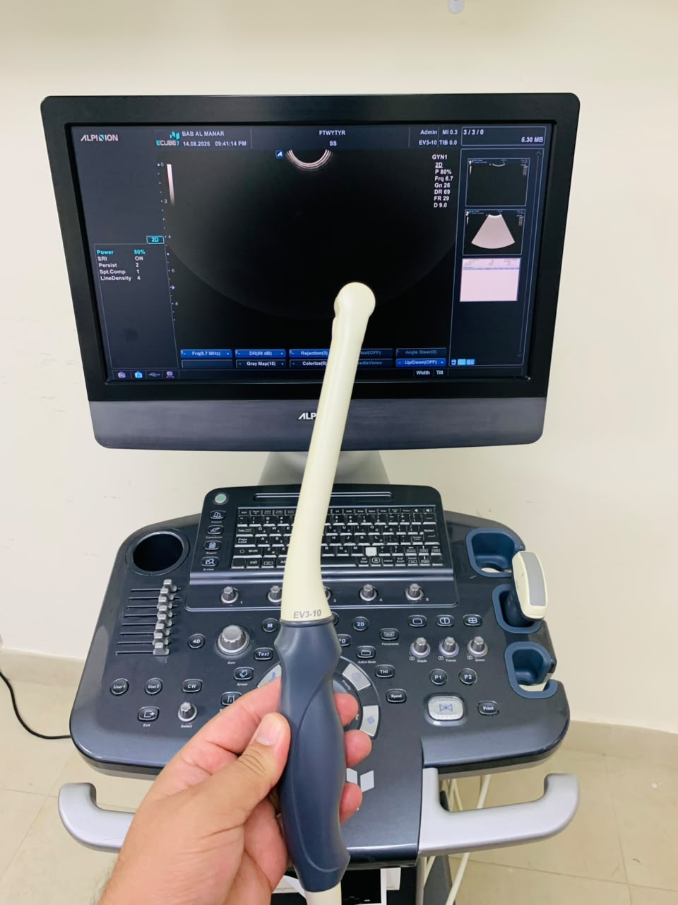 Alpinion E-cube 7 ultrasound machine with TVS and Convex probes. BH