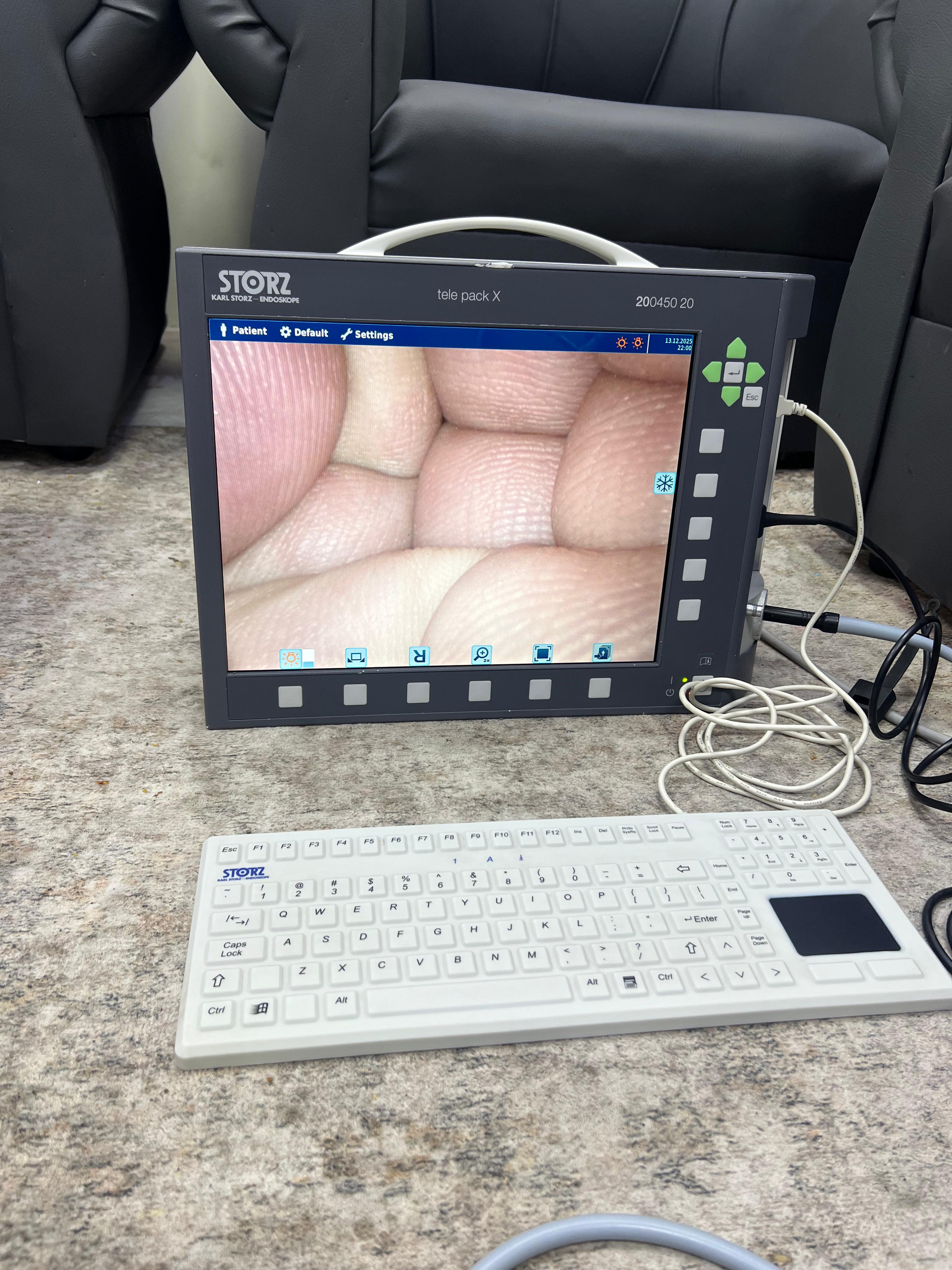 Karl Storz TELE PACK X Portable Endoscopy Camera System | Model 200450 ...