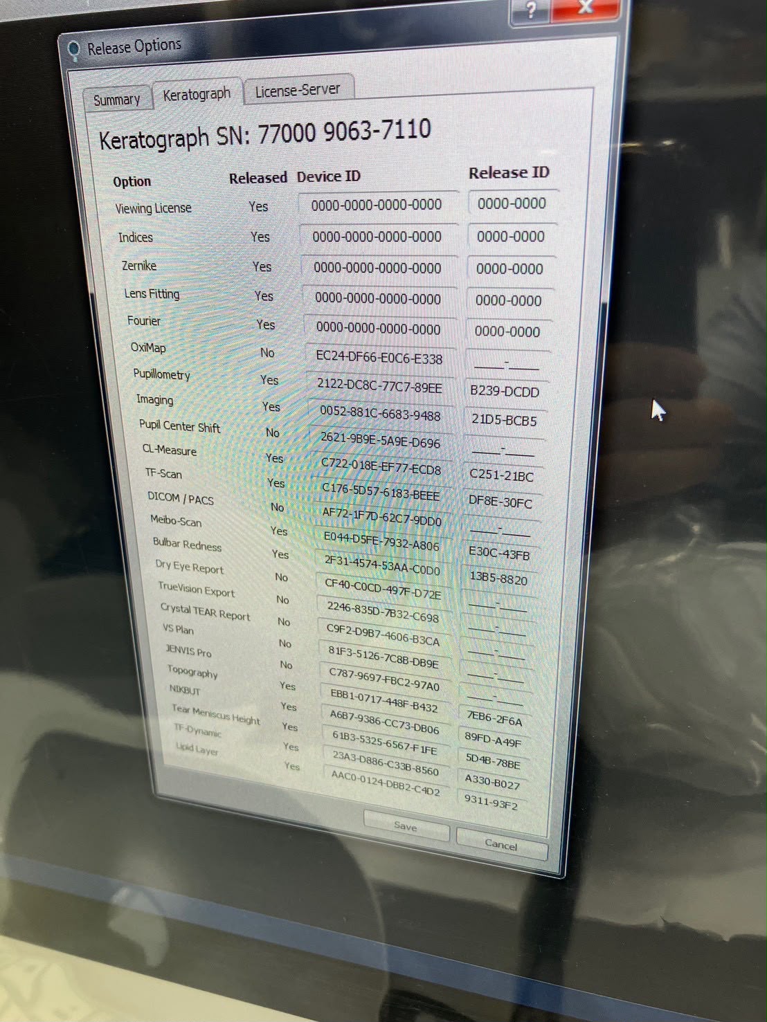 OCULUS keratograph