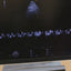 GE S4-10-D Sector Array Probe for Ge voluson E8, E10 ultrasounds BH