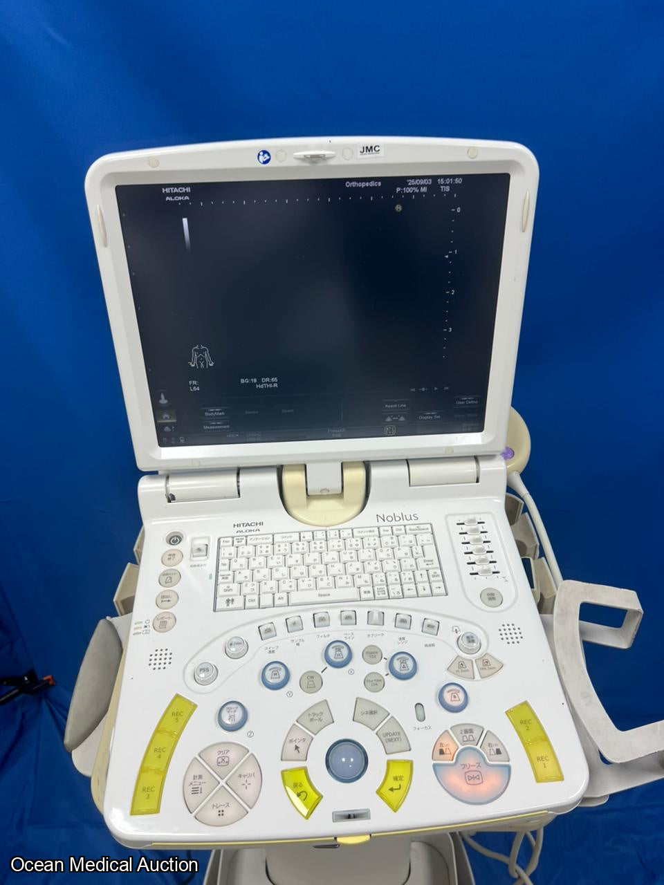 Hitachi Aloka Nobulus Ultrasound System + Linear Transducer (MAF:2013)