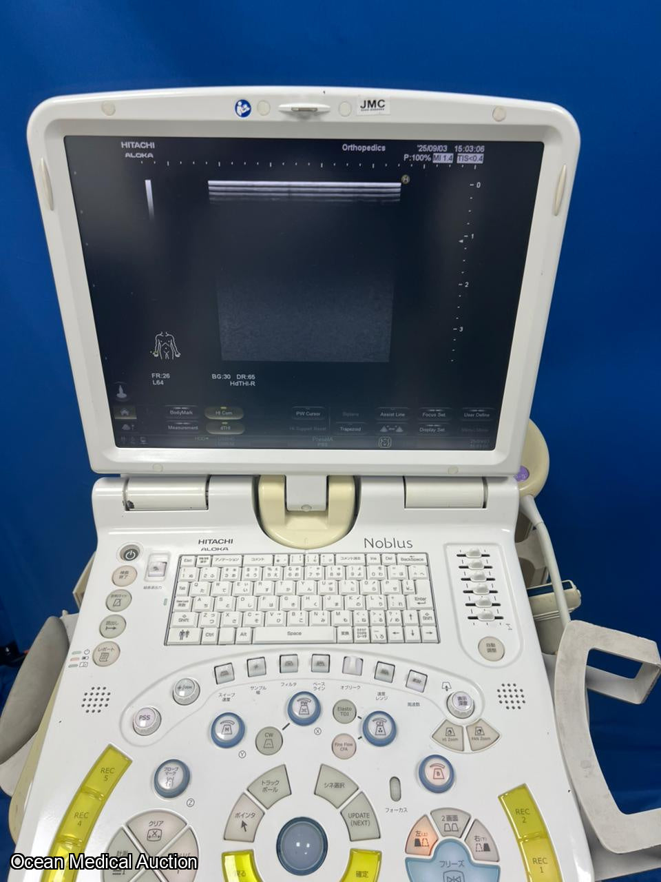 Hitachi Aloka Nobulus Ultrasound System + Linear Transducer (MAF:2013)