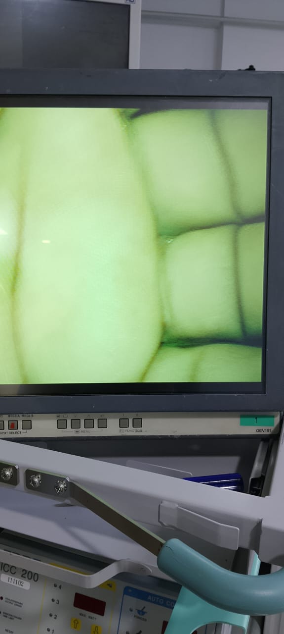 Olympus Rigid Endoscope