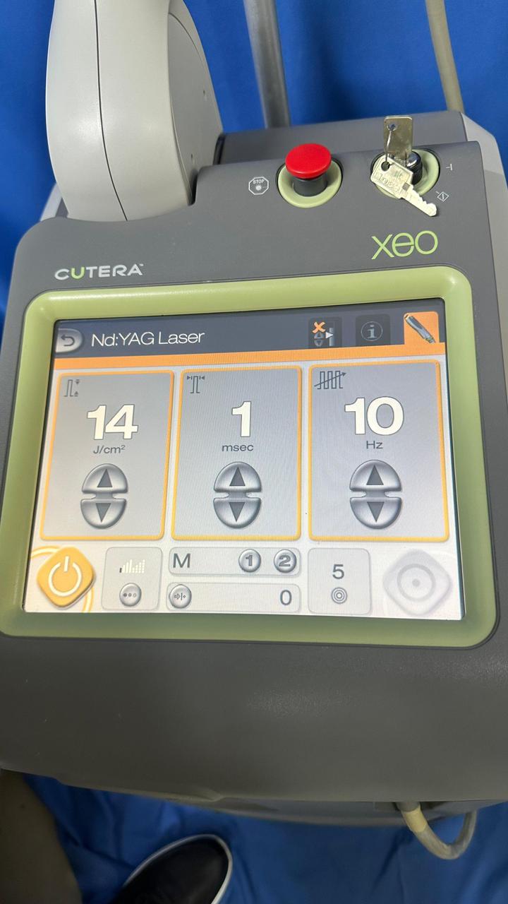 CUTERA XEO Aesthetic Laser System
