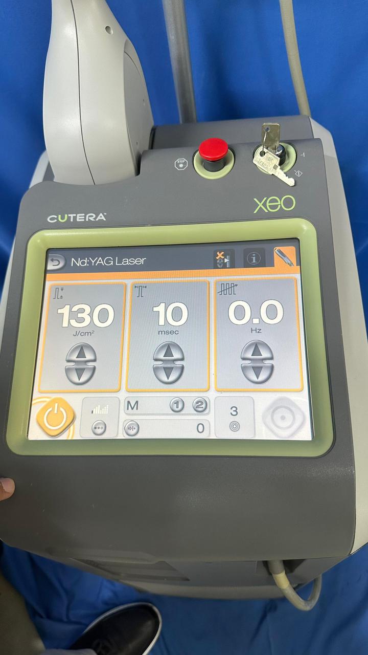 CUTERA XEO Aesthetic Laser System