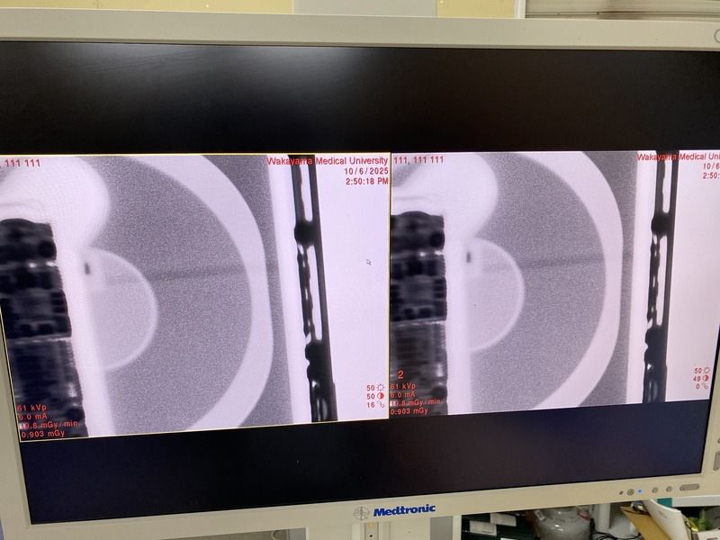 Medtronic O-Arm Surgical 3D Imaging System – 2013 Manufacturing –Good Condition