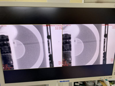 Medtronic O-Arm Surgical 3D Imaging System – 2013 Manufacturing –Good Condition