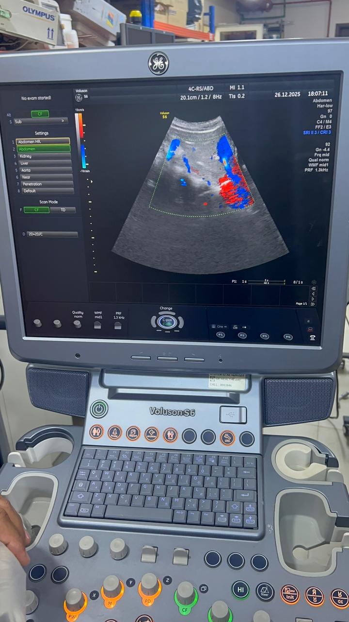 GE Voluson S6 with convex and TVS probe Year 2013