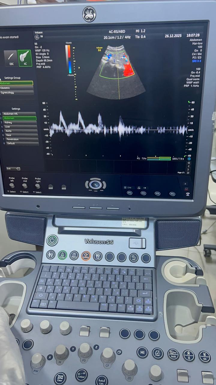 GE Voluson S6 with convex and TVS probe Year 2013