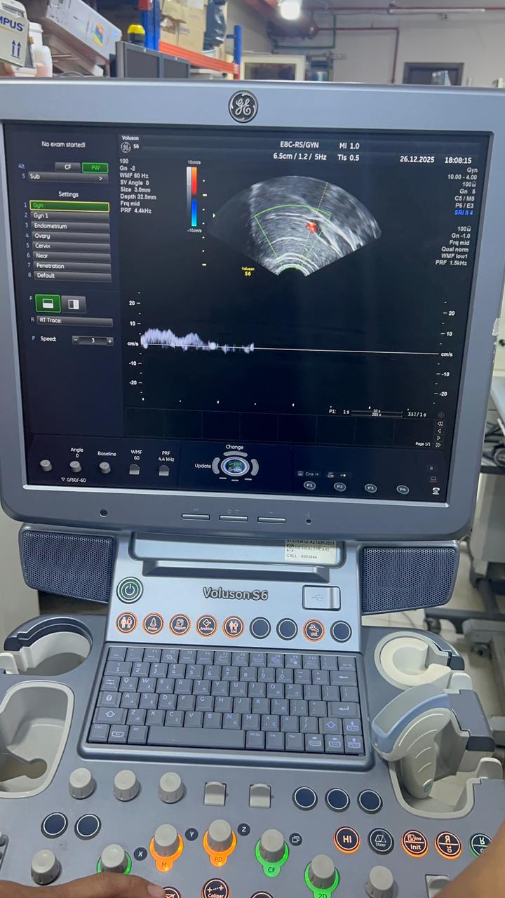 GE Voluson S6 with convex and TVS probe Year 2013
