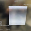 Hitachi Arreita 70 with 4 Probes Ultrasound (Refurbished equipment)