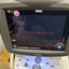 NIDEK RS-3000 Retina Scan – Spectral Domain Optical Coherence Tomography (SD-OCT) System