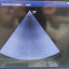 GE Healthcare LOGIQ S8 Diagnostic Ultrasound System