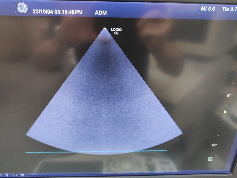 GE Healthcare LOGIQ S8 Diagnostic Ultrasound System