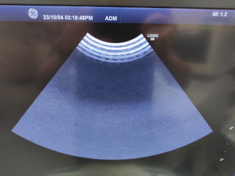 GE Healthcare LOGIQ S8 Diagnostic Ultrasound System