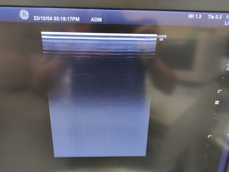 GE Healthcare LOGIQ S8 Diagnostic Ultrasound System