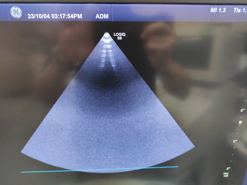 GE Healthcare LOGIQ S8 Diagnostic Ultrasound System