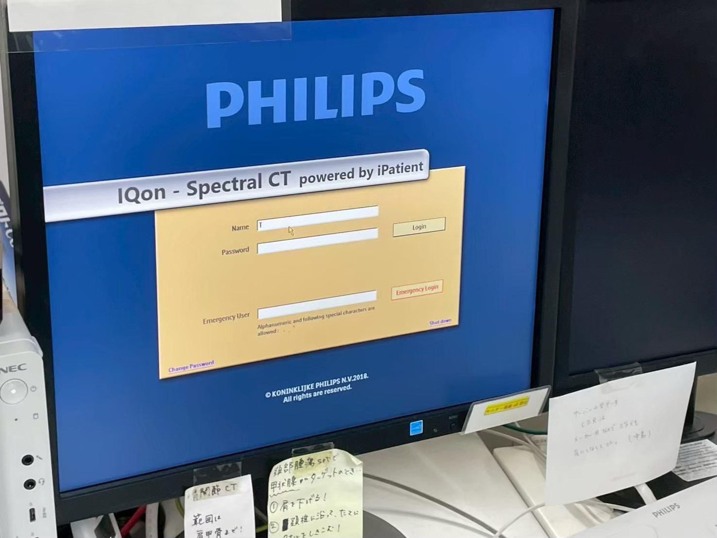 PHILIPS IQON SPECTRAL CT 256 YOM 2017 refurbished equipment