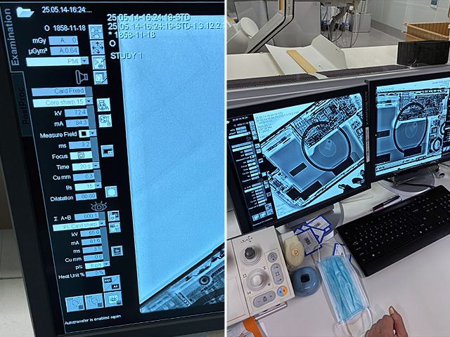 Siemens Artis zee BC Digital Angiography System (Cath Lab System)