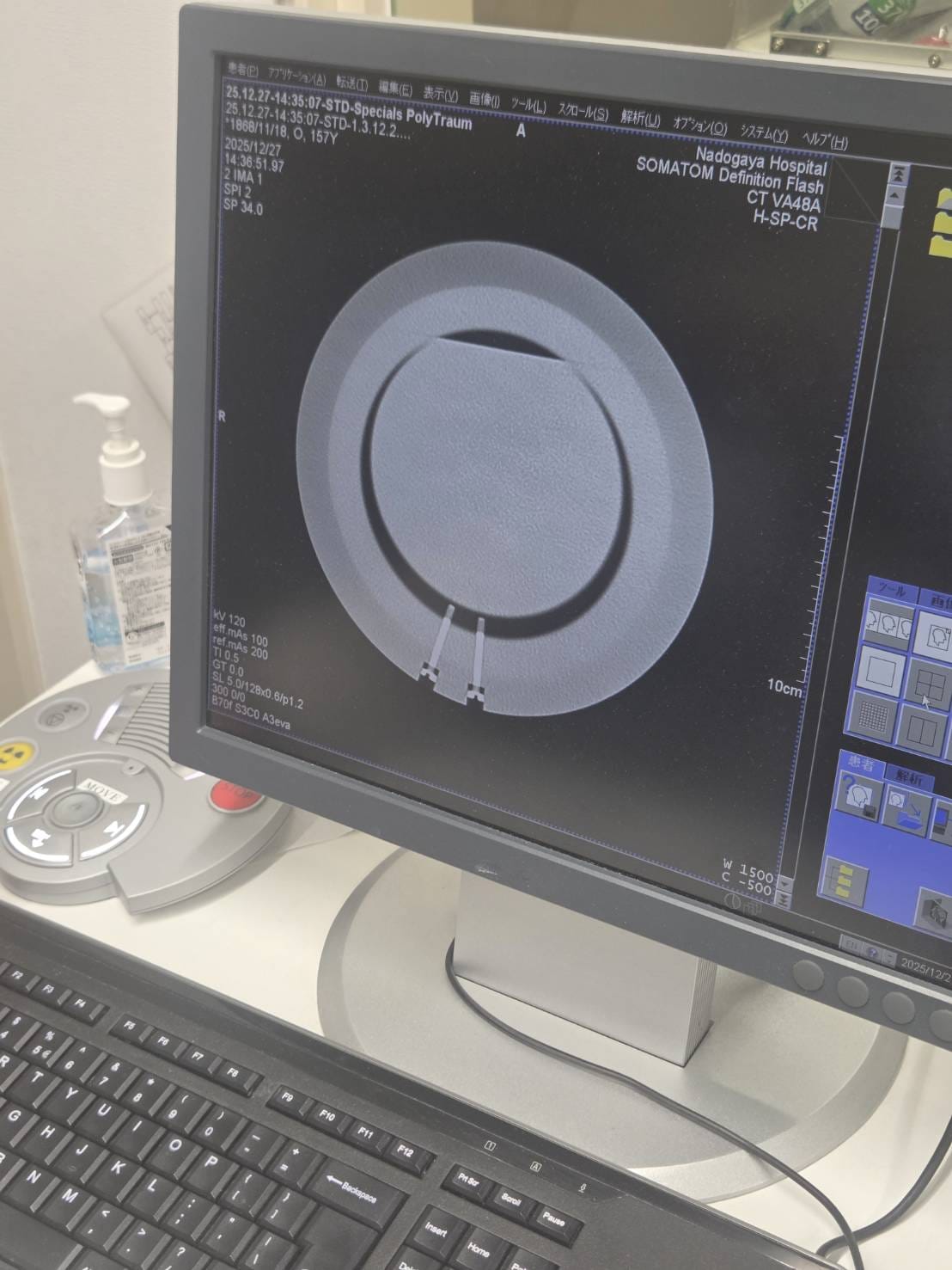 Siemens SOMATOM Definition Flash Dual-Source CT Scanner