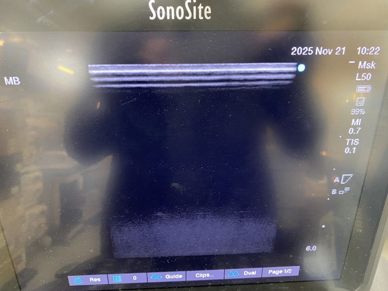 FUJIFILM SonoSite Edge II Total – Portable Point-of-Care Ultrasound System