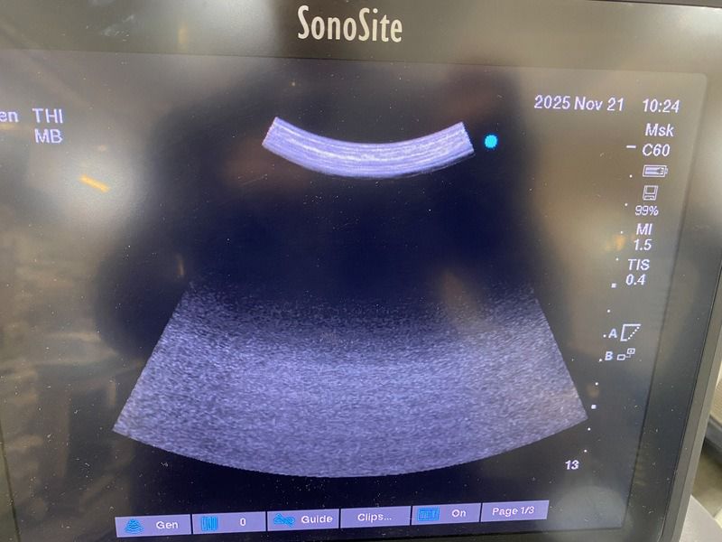 FUJIFILM SonoSite Edge II Total – Portable Point-of-Care Ultrasound System