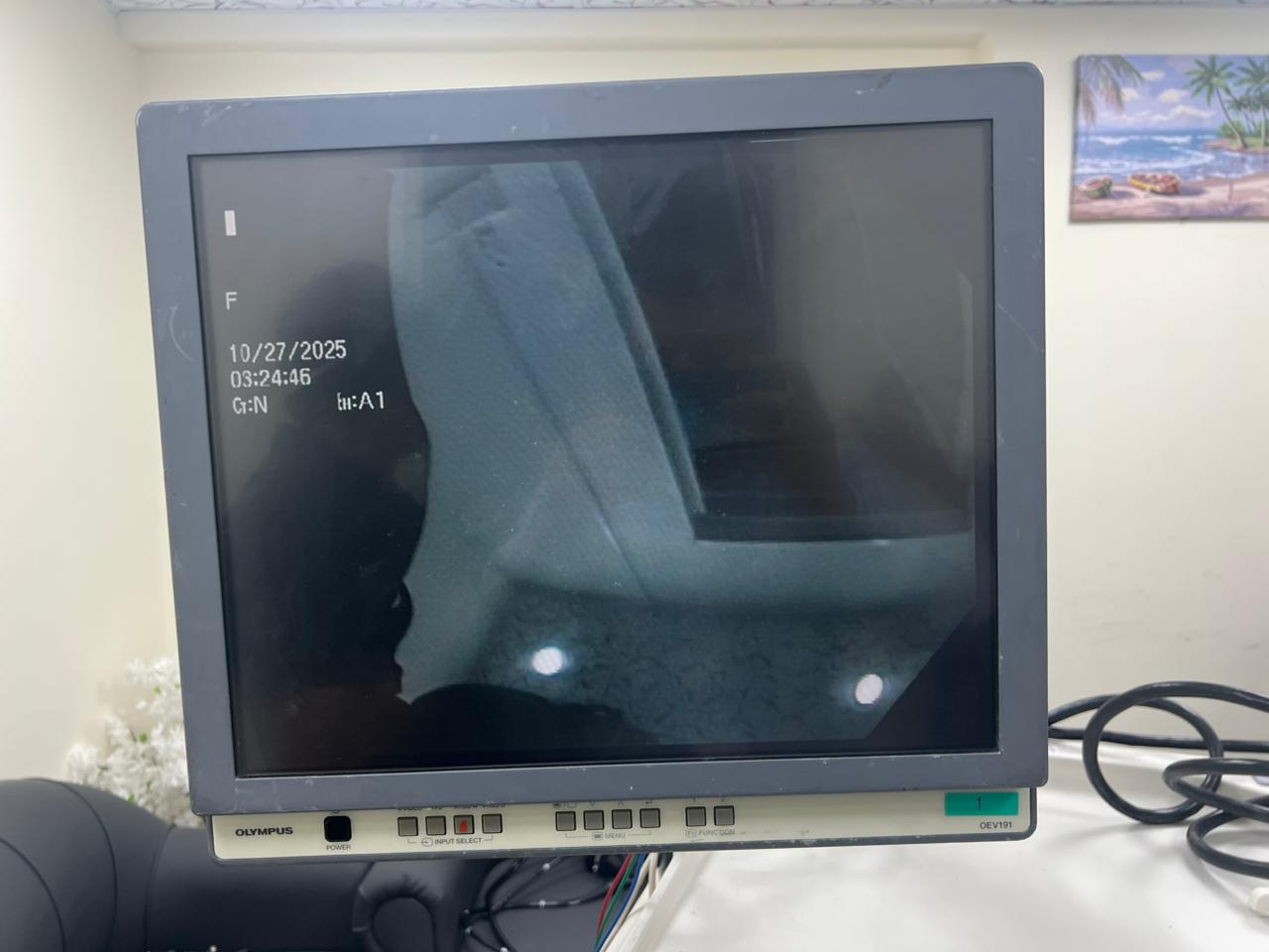 Olympus EVIS EXERA II Endoscopy System (REFURBISHED EQUIPMENT)