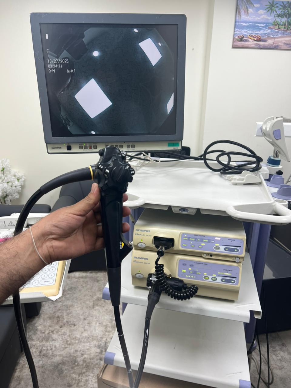 Olympus EVIS EXERA II Endoscopy System (REFURBISHED EQUIPMENT)