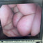 Olympus EVIS EXERA III CV-170 HD Endoscopy System (REFURBISHED EQUIPMENT)