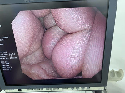 Olympus EVIS EXERA III CV-170 HD Endoscopy System (REFURBISHED EQUIPMENT)