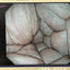 Olympus EVIS X1 CV-1500 Endoscopy Processor