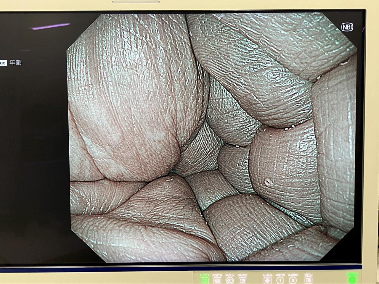 Olympus EVIS X1 CV-1500 Endoscopy Processor