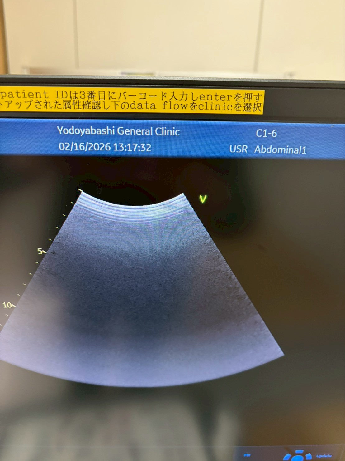 GE Vivid E95 Ultra Edition V206 Ultrasound with sector probe, 4D probe, linear probe and convex probe.