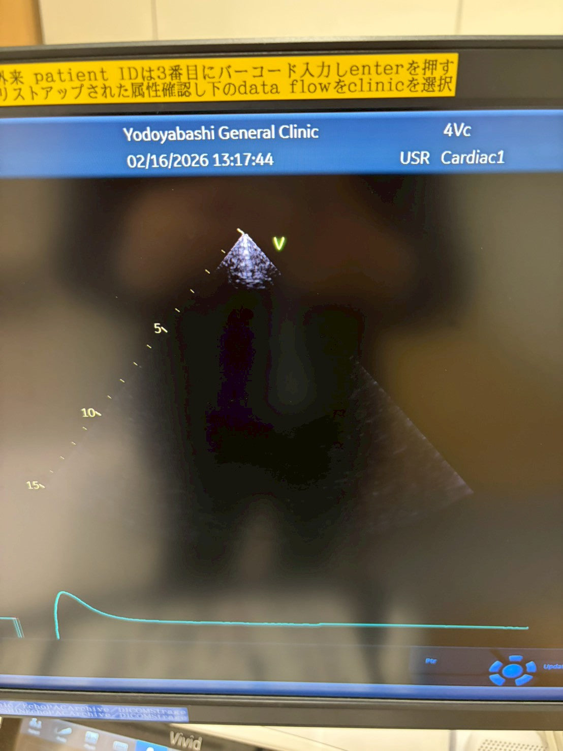 GE Vivid E95 Ultra Edition V206 Ultrasound with sector probe, 4D probe, linear probe and convex probe.