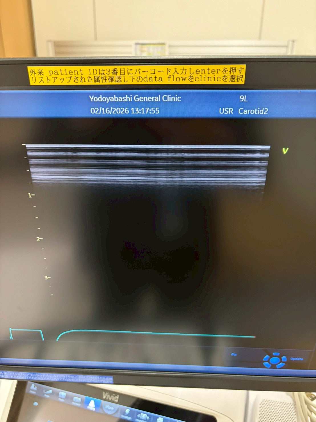 GE Vivid E95 Ultra Edition V206 Ultrasound with sector probe, 4D probe, linear probe and convex probe.