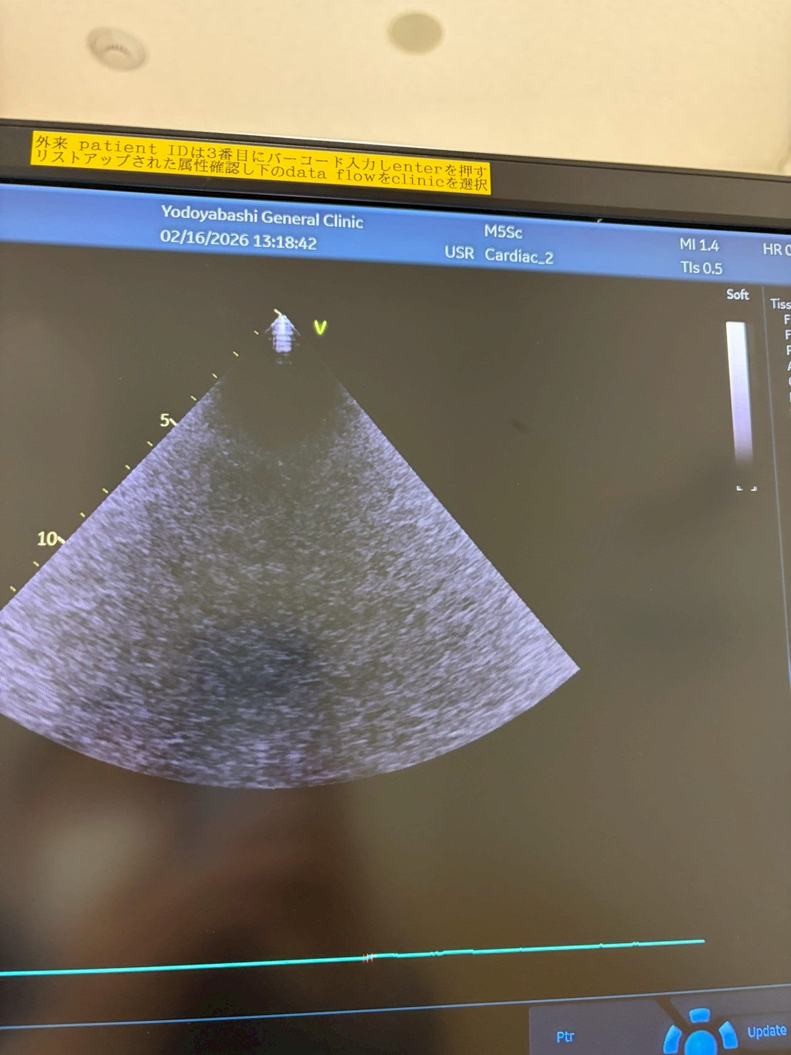 GE Vivid E95 Ultra Edition V206 Ultrasound with sector probe, 4D probe, linear probe and convex probe.