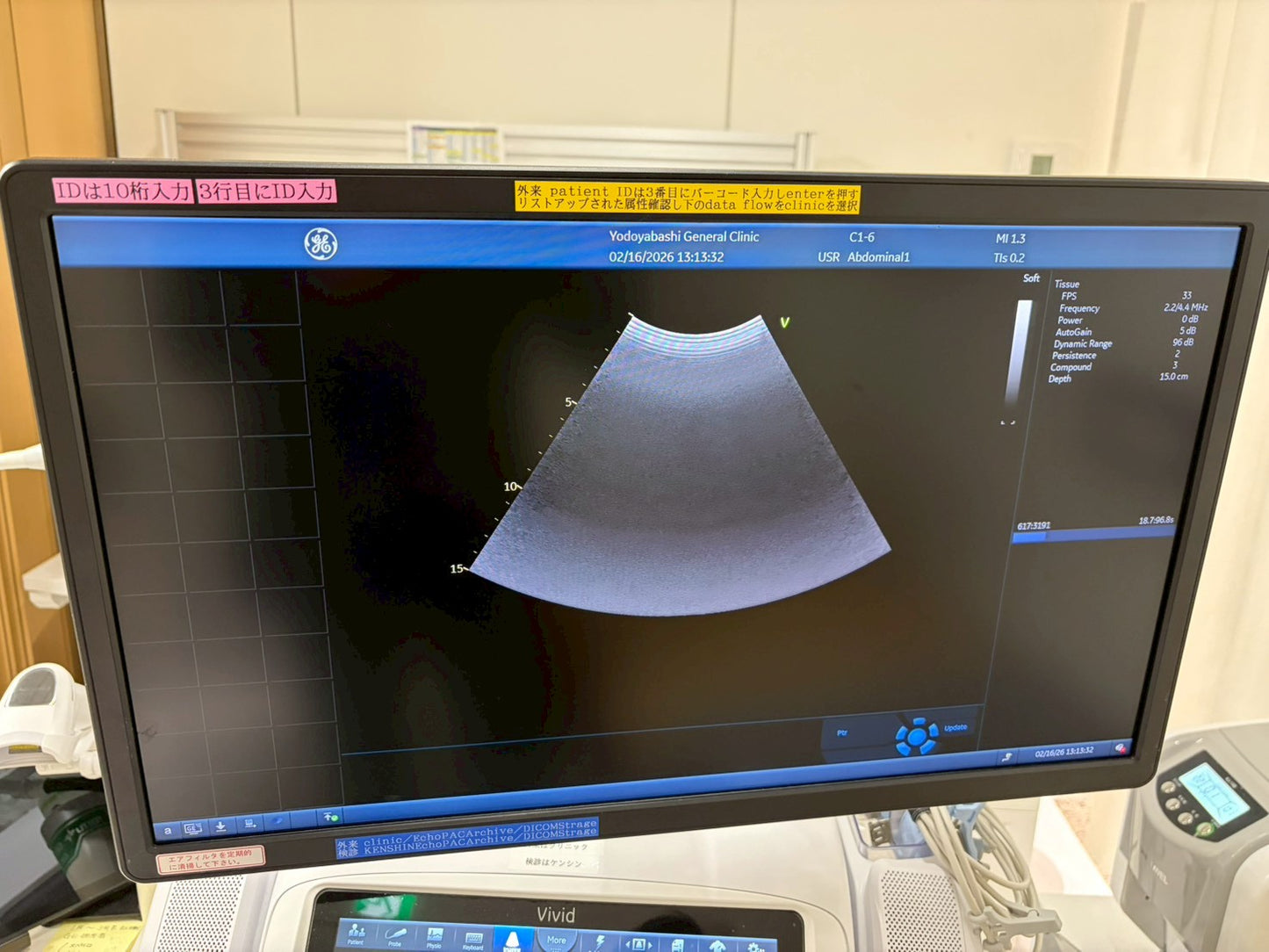 GE Vivid E95 Ultra Edition V206 Ultrasound with sector probe, 4D probe, linear probe and convex probe.