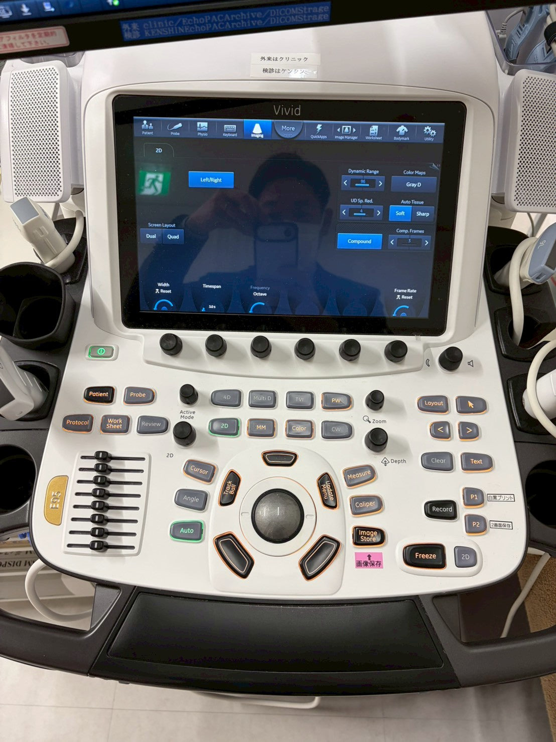 GE Vivid E95 Ultra Edition V206 Ultrasound with sector probe, 4D probe, linear probe and convex probe.