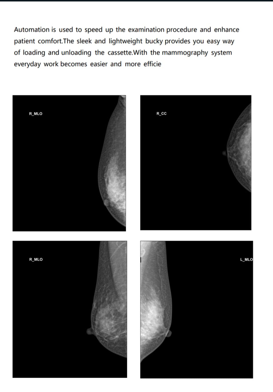 MSLRX13 Digital Mammography System – High Frequency 6kW Breast Imaging Unit with Flat Panel Detector