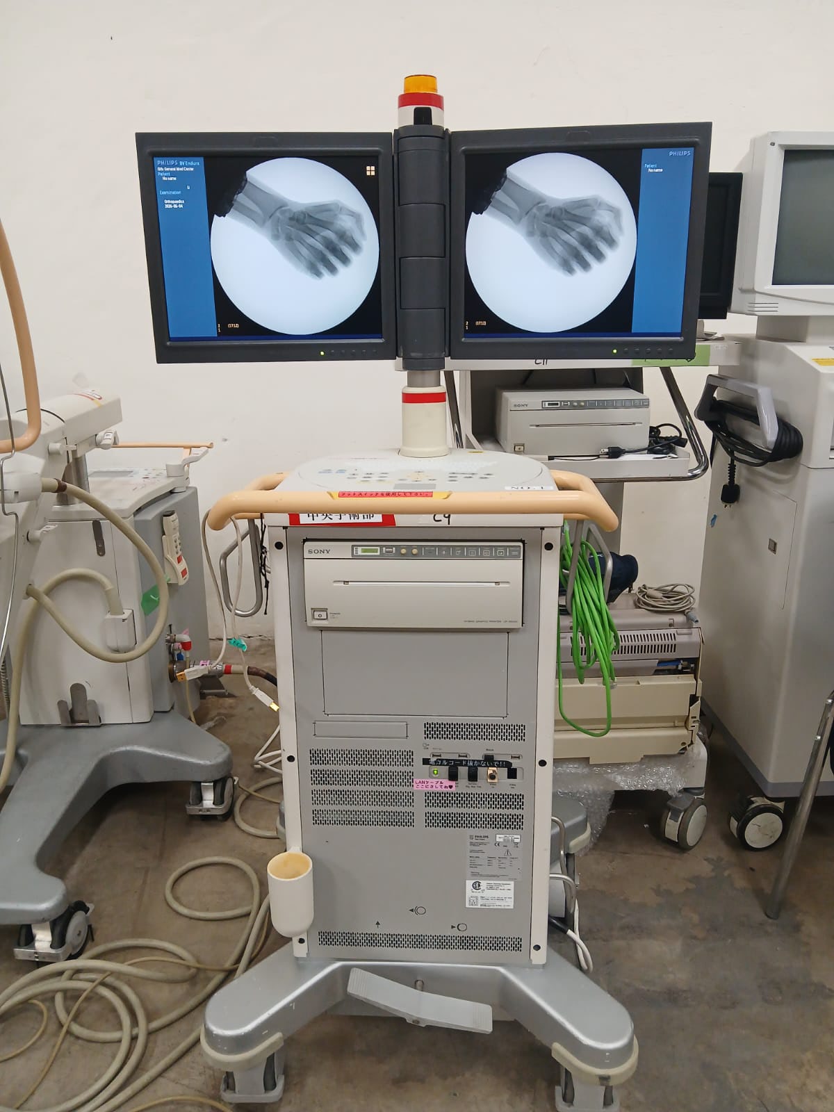 Philips BV Pulsera C Arm refurbished machine