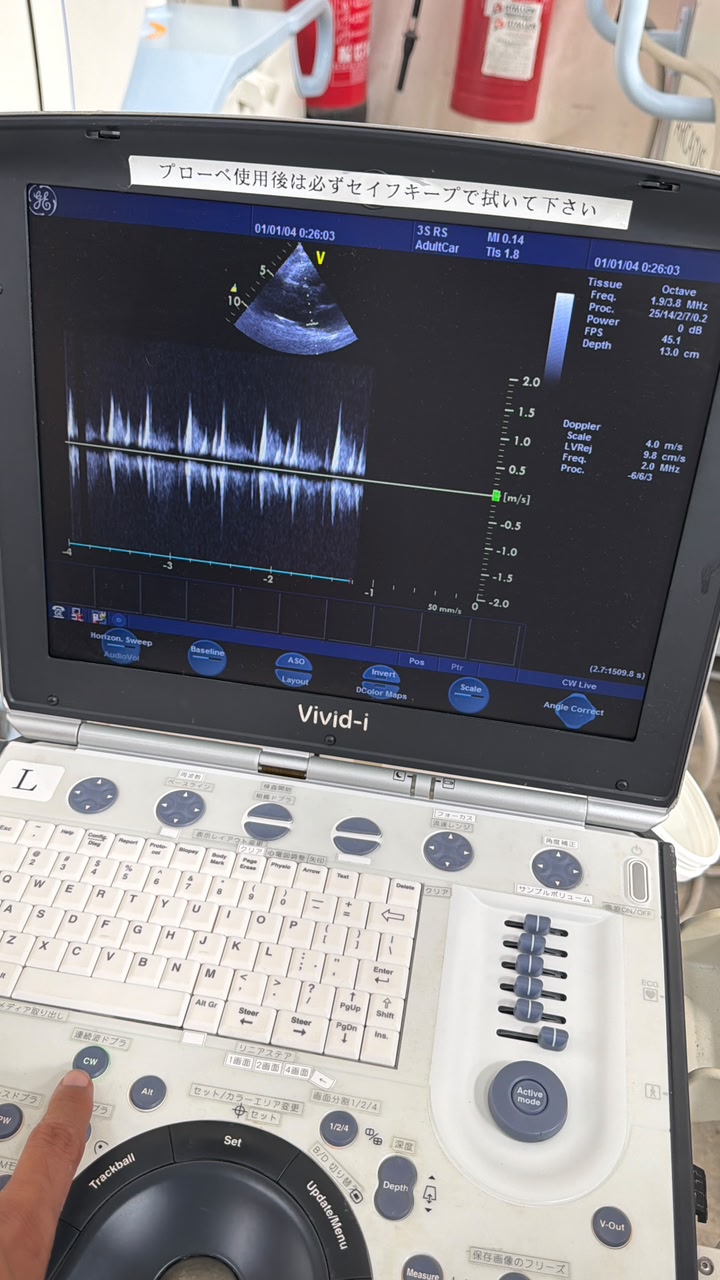 GE Vivid i with Cardiac probe Portable Ultrasound, With printer With trolly refurbished machine