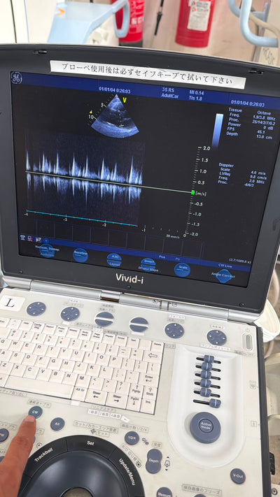 GE Vivid i with Cardiac probe Portable Ultrasound, With printer With trolly refurbished machine