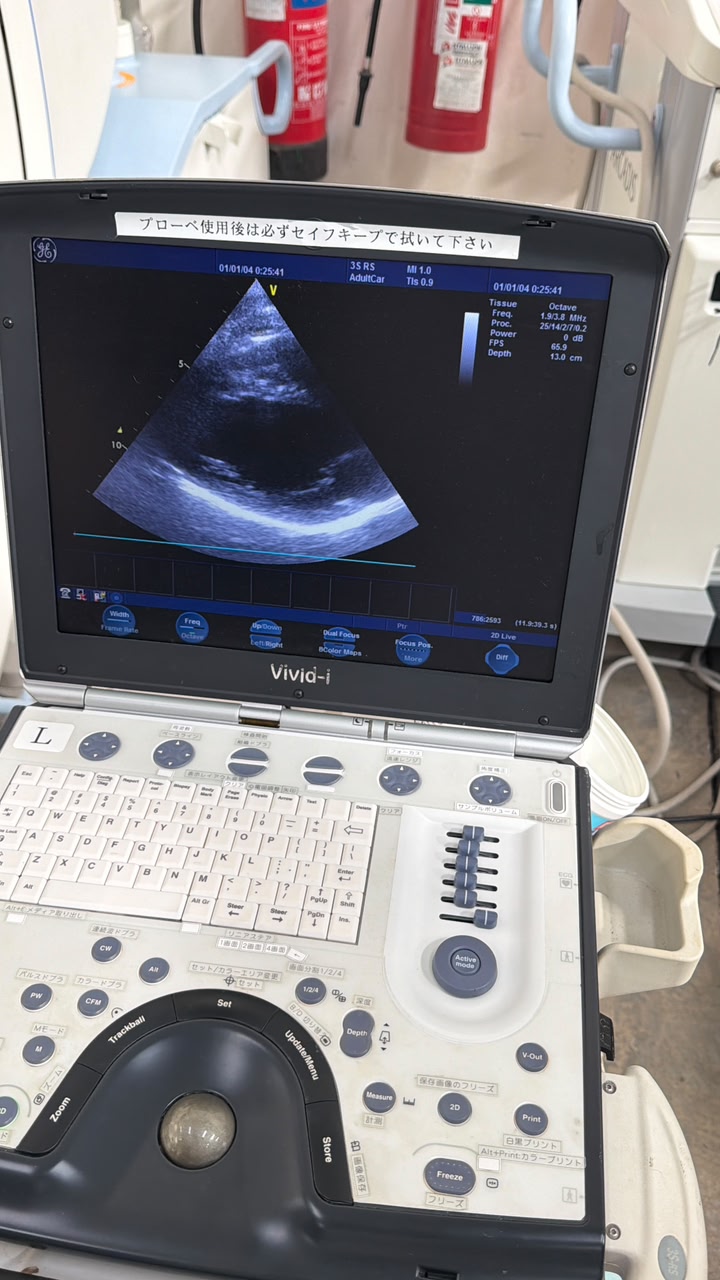 GE Vivid i with Cardiac probe Portable Ultrasound, With printer With trolly refurbished machine