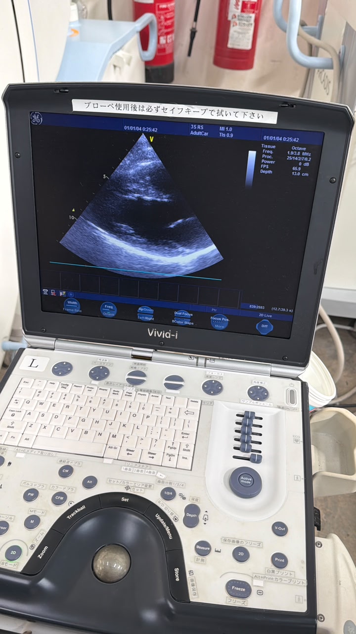 GE Vivid i with Cardiac probe Portable Ultrasound, With printer With trolly refurbished machine